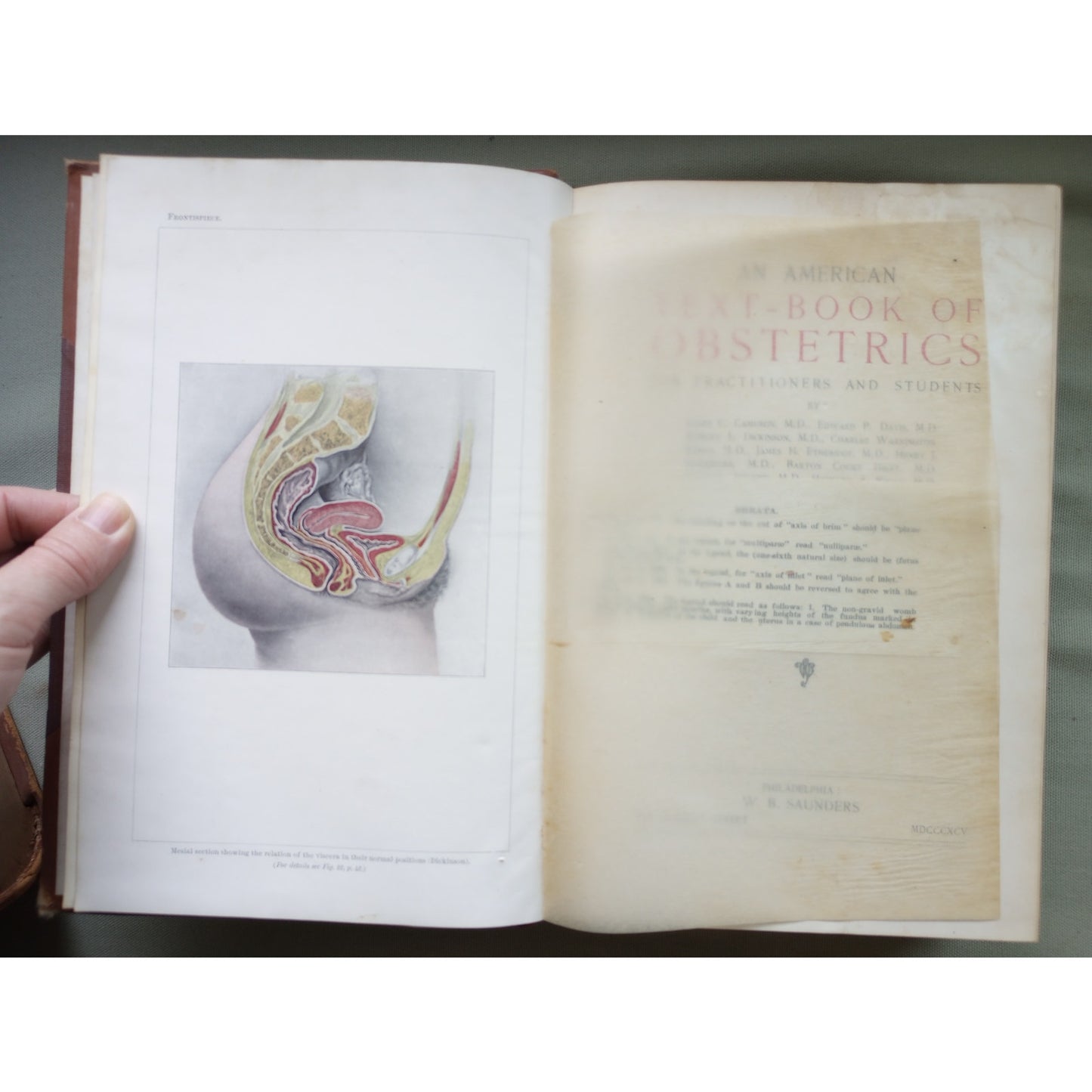 American Text-book of Obstetrics For Practitioners & Students 1895 Illustrated