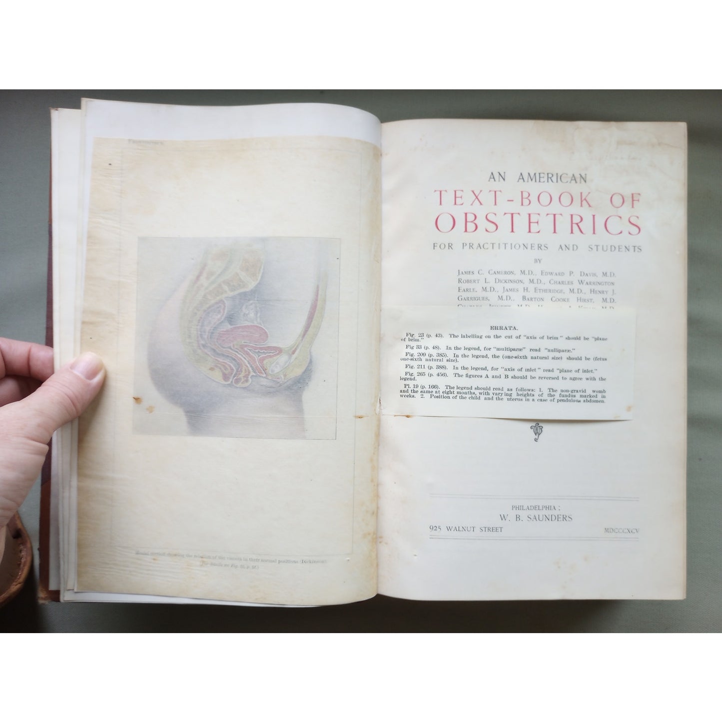 American Text-book of Obstetrics For Practitioners & Students 1895 Illustrated